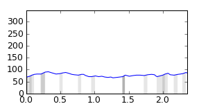 segment 25 small profile